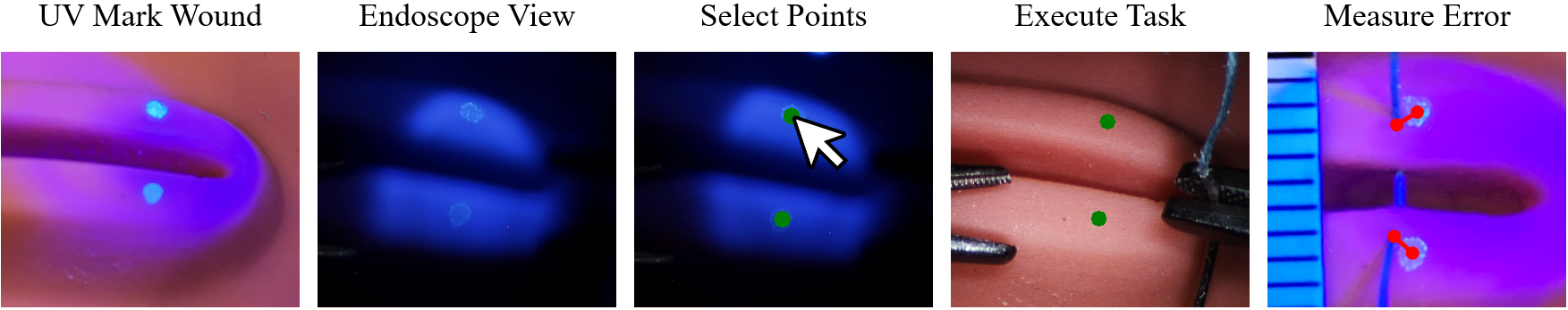 Precision measurement using invisible UV markers, from marking the wound to measuring the error post-execution.