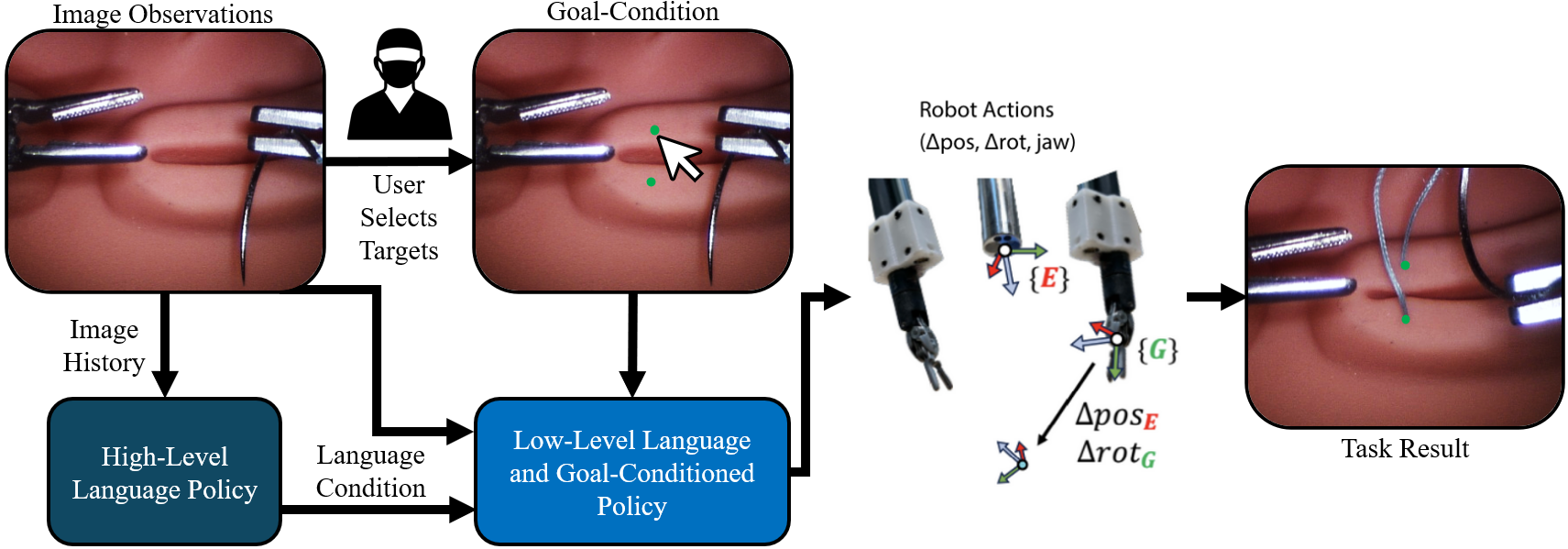 Overview of the precision-conditioned control framework for long-horizon, dexterous surgical tasks.