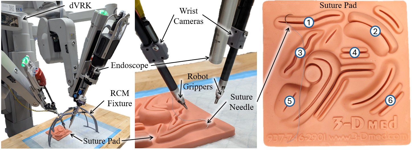 Experimental setup showing the Da Vinci Research Kit (dVRK), RCM fixture, and suture pad with wound types.