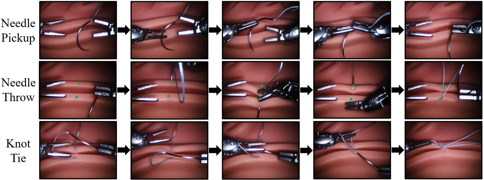 The suturing procedure broken into three tasks: needle pickup, needle throw, and knot tie.